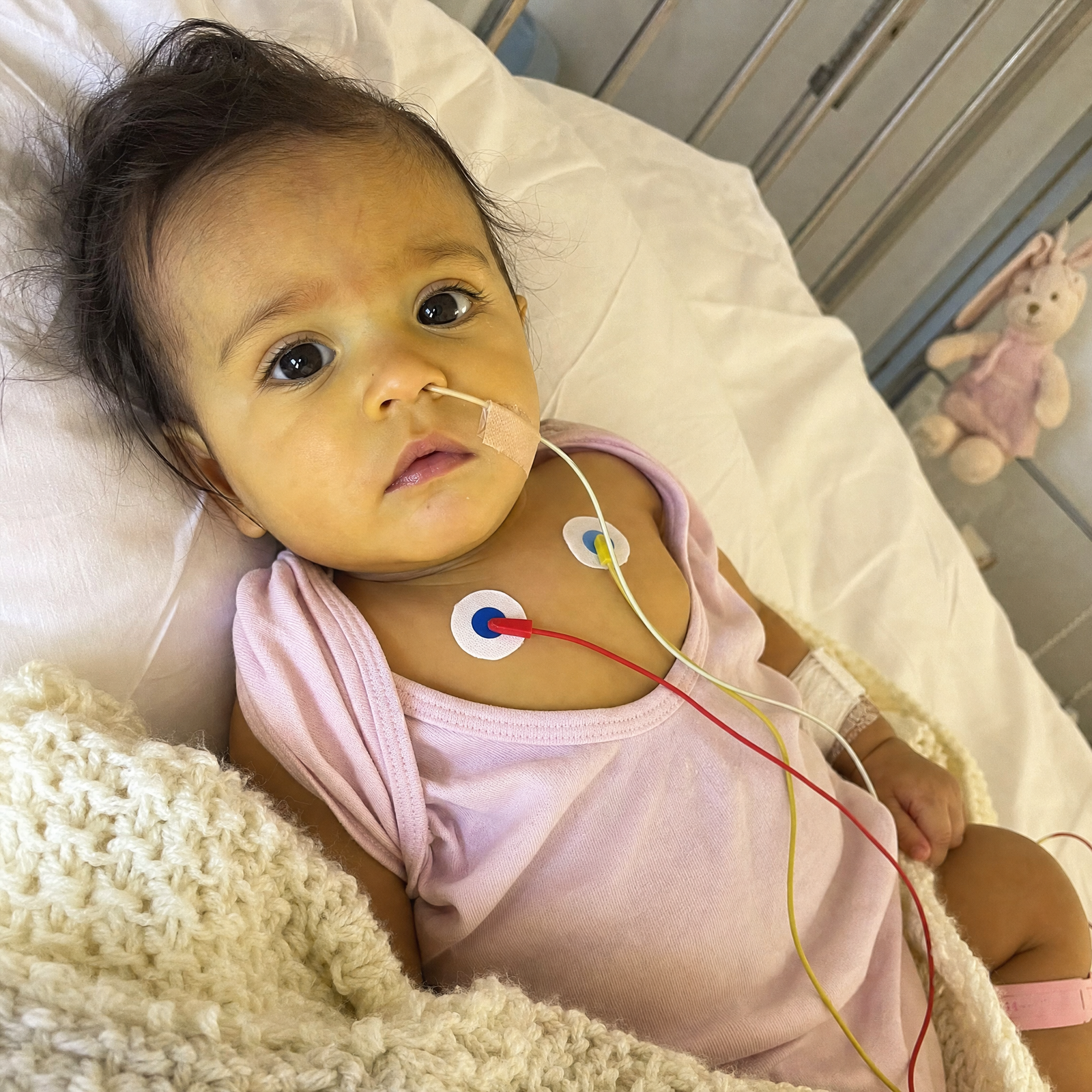 Valentina, una beba con atresia biliar que necesita un trasplante hepático